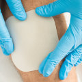 The 5 Essential Rules of Wound Dressing: A Comprehensive Guide for Healthcare Professionals