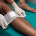 The Importance of Gauze Pads in Treating Injuries