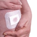 The Role of Gauze in Advanced Wound Care